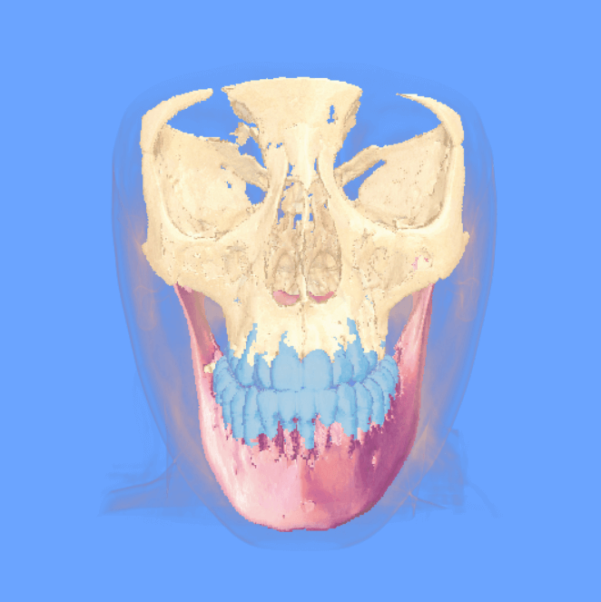 Advanced visualization of medical models image