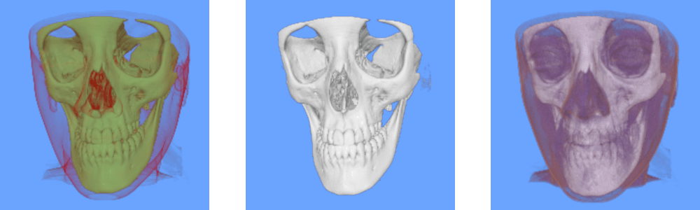 Results 1 image