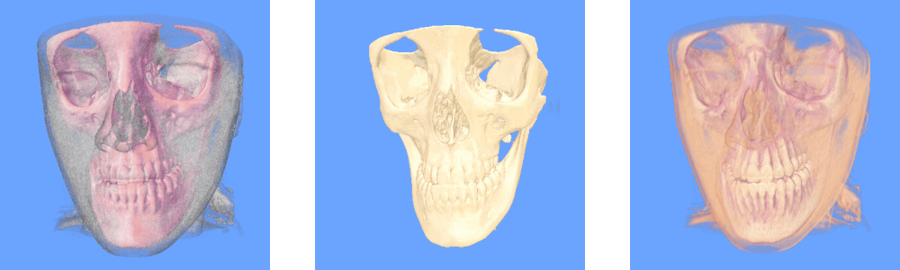 Results 2 image