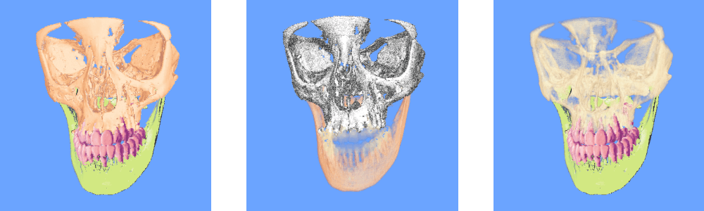 Results 3 image